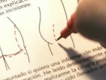 Cirugía