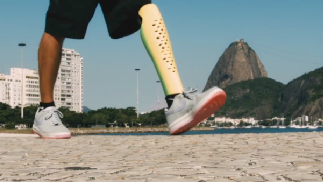 Confetti Prosthetic Leg Cover