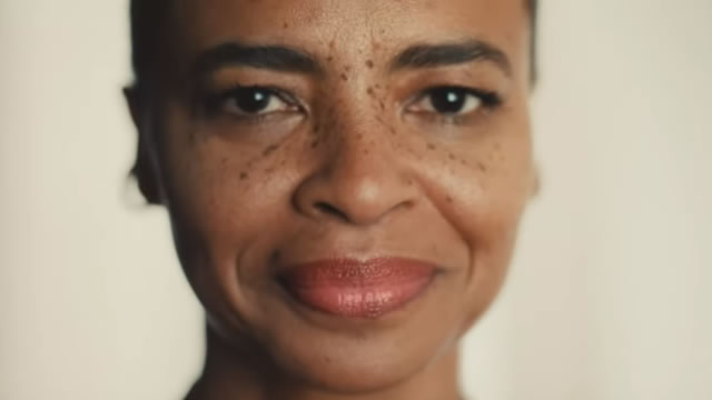 The Unlimited Power of Beauty