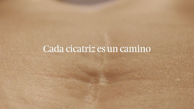 Sí me importa