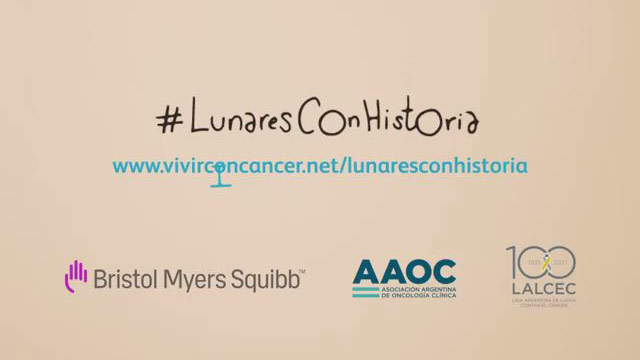 Lunares con historia