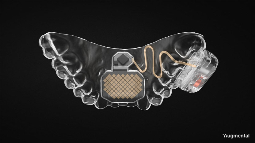 MouthPad 2