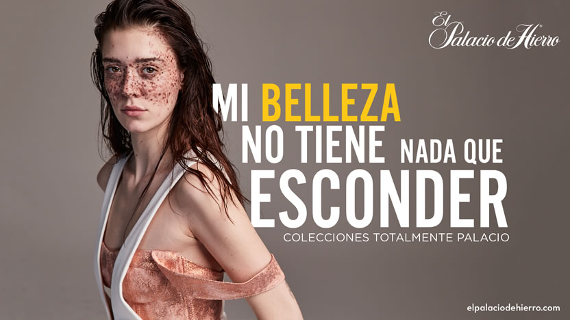 Belleza