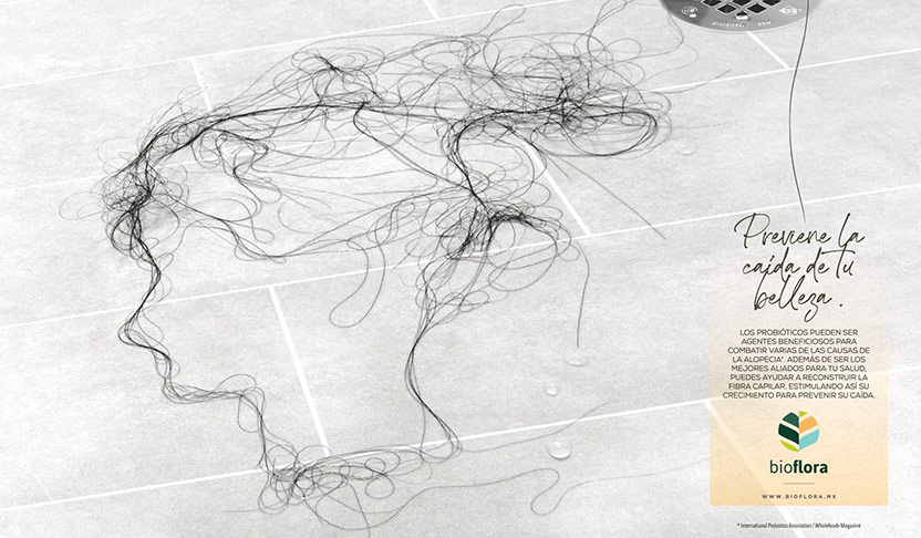 Hair Loss 2