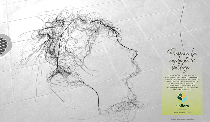 Hair Loss 3