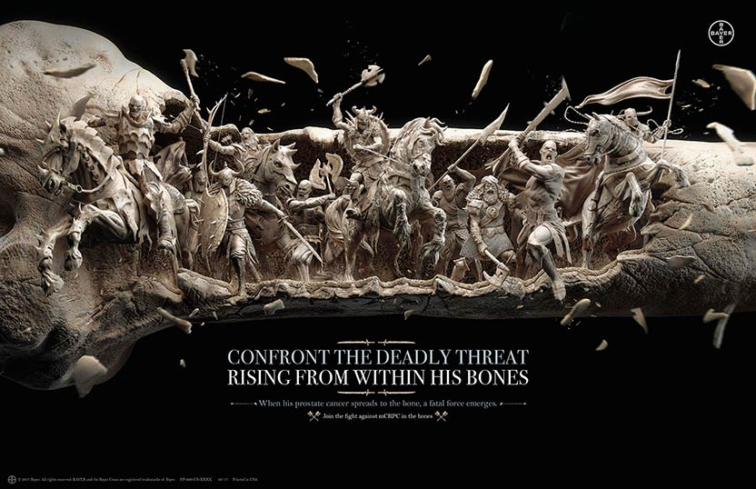 Bone battle