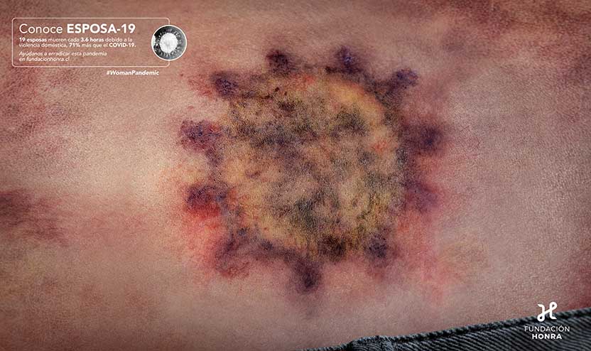 Campaña Fundación Honra - #WomanPandemic