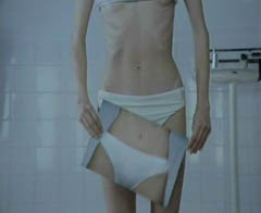Anorexia