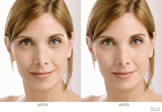 Gráfica Hinds Anti Age