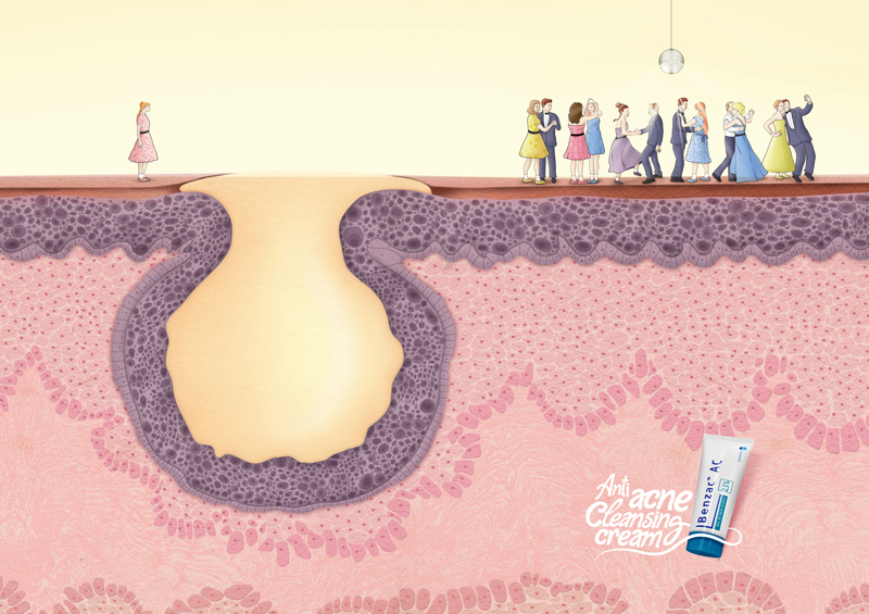 Campaña Benzac Crema Antiacne
