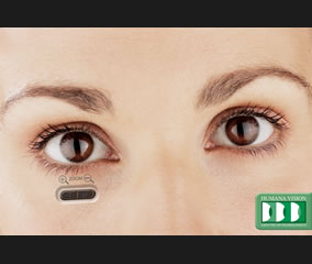 Zoom 3